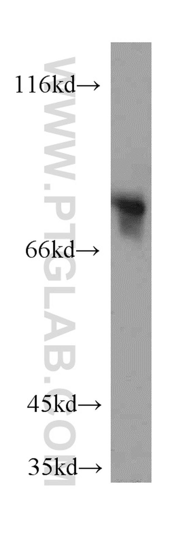 MYST2 Antibody in Western Blot (WB)