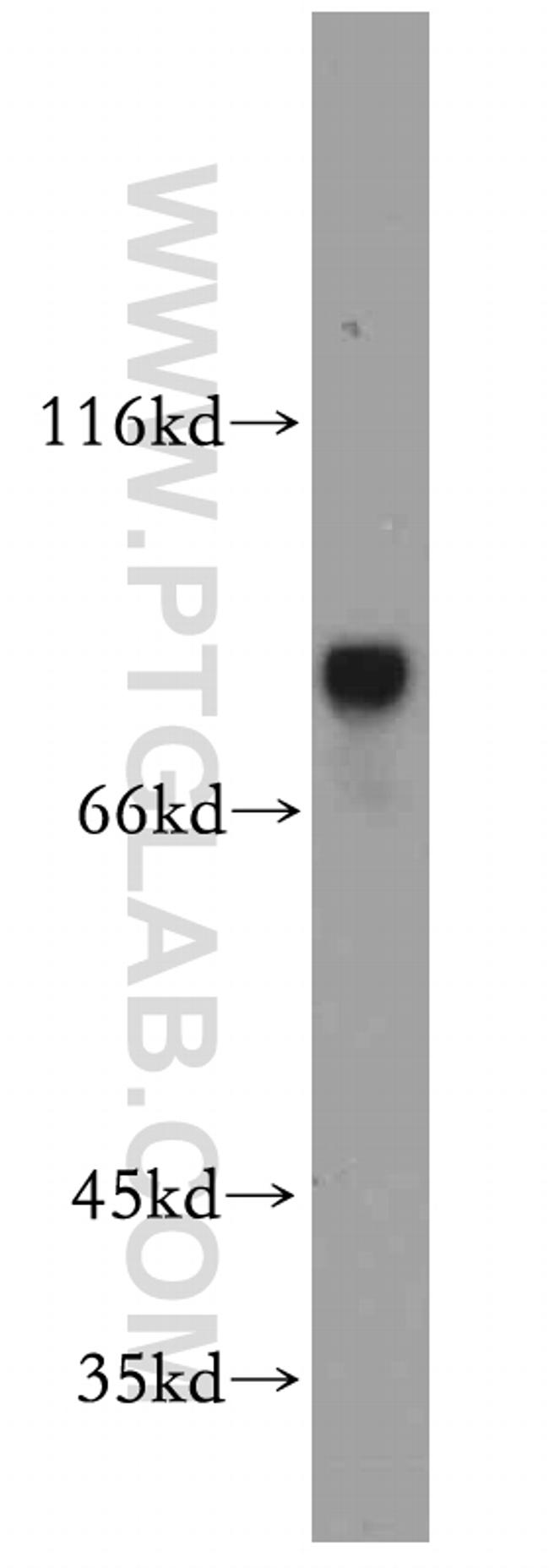 MYST2 Antibody in Western Blot (WB)