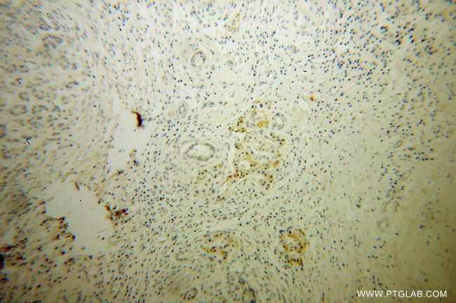 RNase T2 Antibody in Immunohistochemistry (Paraffin) (IHC (P))