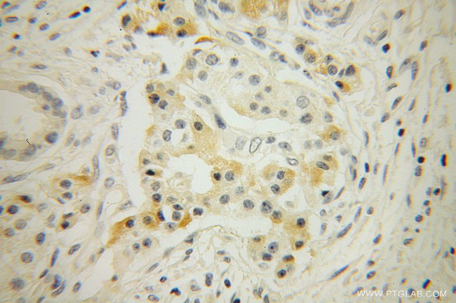 RNase T2 Antibody in Immunohistochemistry (Paraffin) (IHC (P))