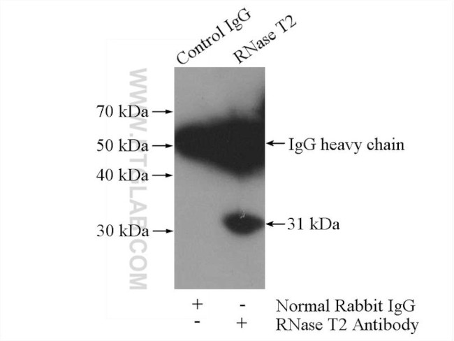 RNase T2 Antibody in Immunoprecipitation (IP)