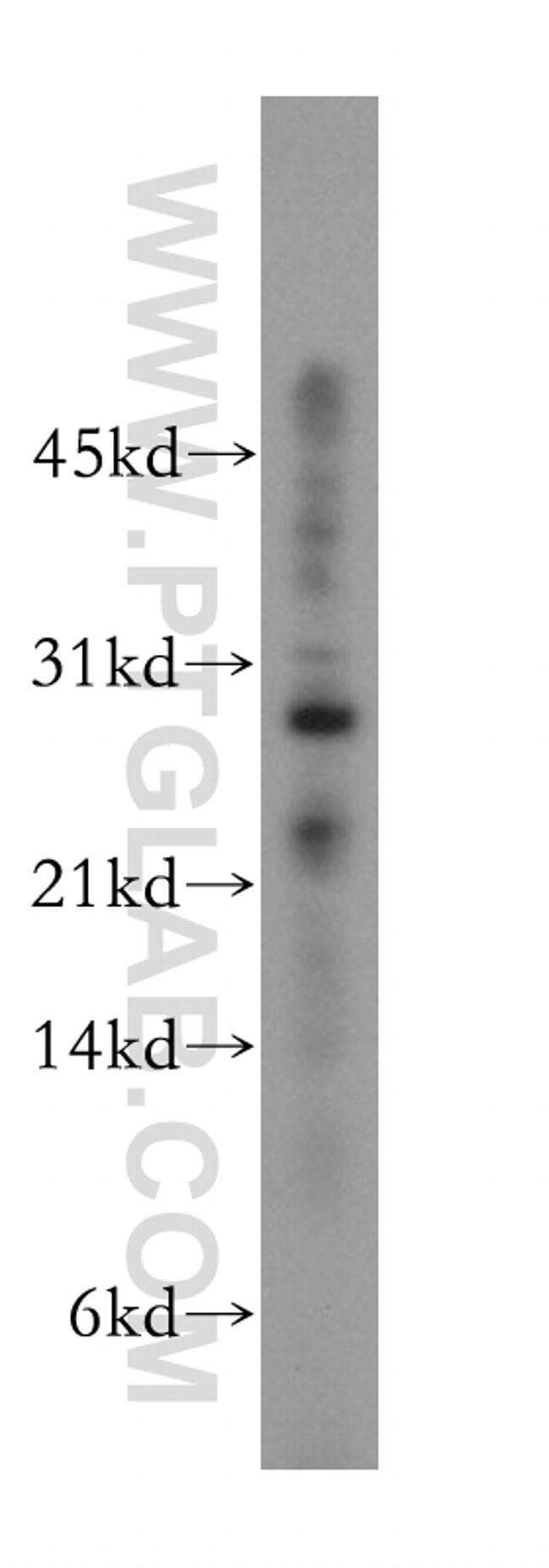 RNase T2 Antibody in Western Blot (WB)