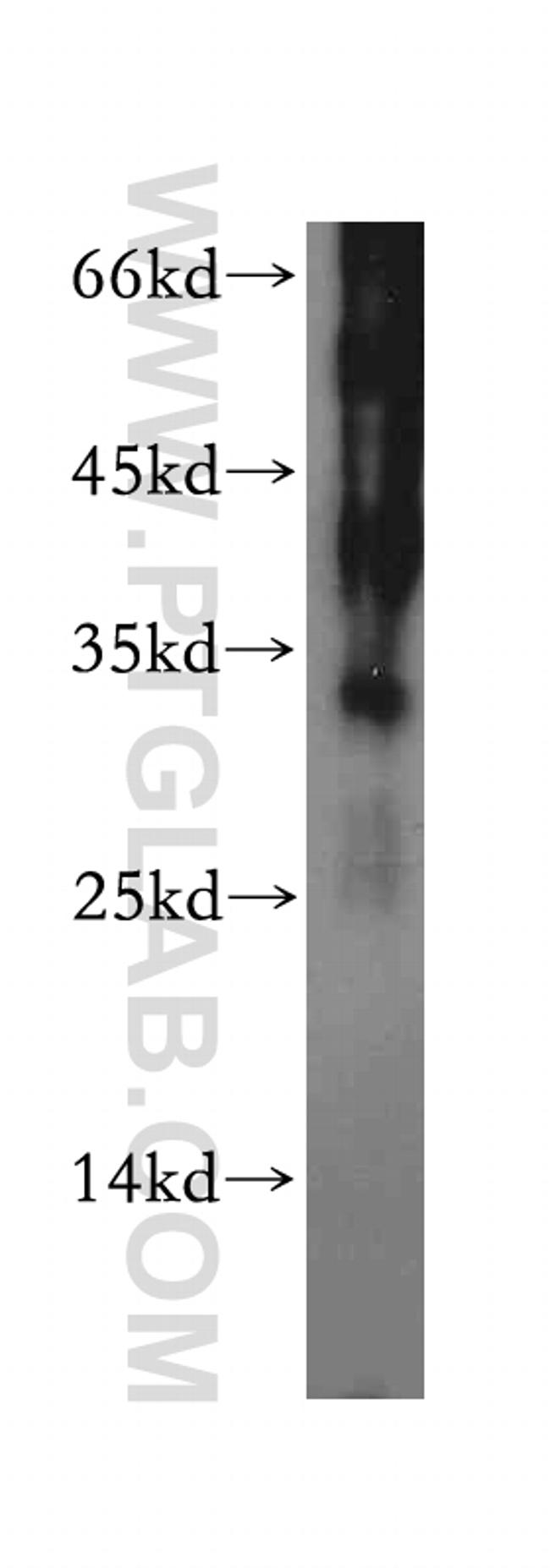 RNase T2 Antibody in Western Blot (WB)