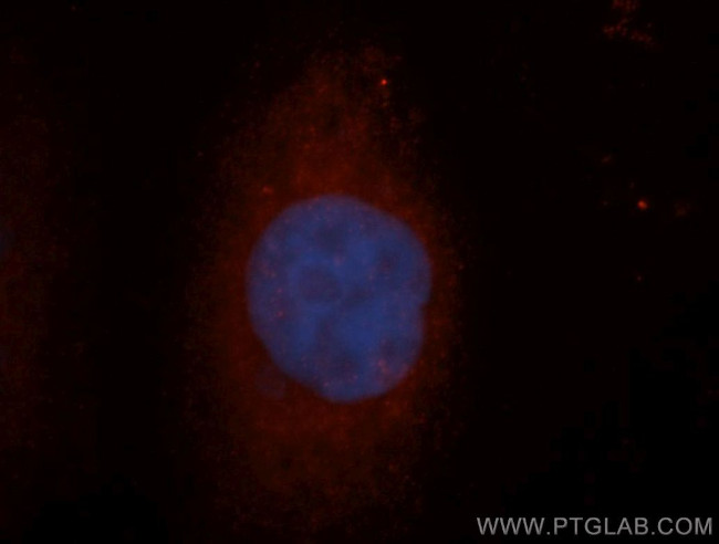 FMRP Antibody in Immunocytochemistry (ICC/IF)