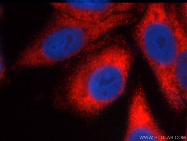 FMRP Antibody in Immunocytochemistry (ICC/IF)