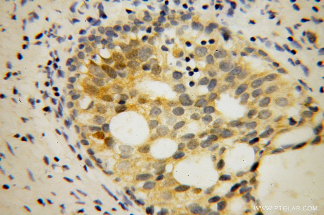 FMRP Antibody in Immunohistochemistry (Paraffin) (IHC (P))