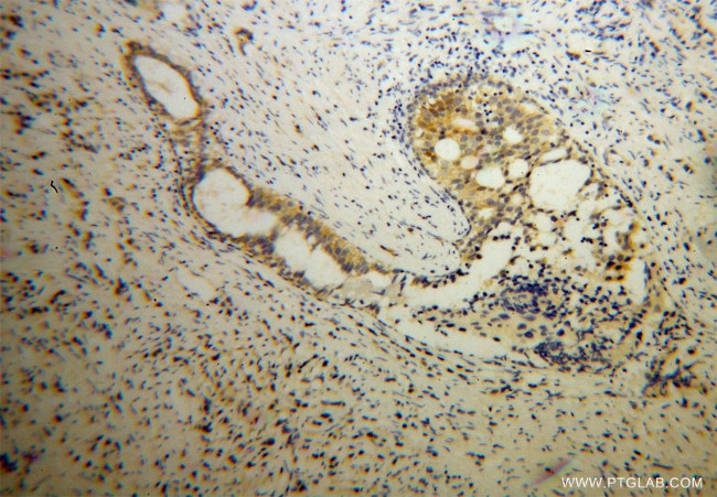 FMRP Antibody in Immunohistochemistry (Paraffin) (IHC (P))