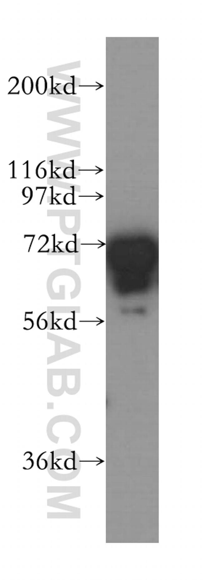 FMRP Antibody in Western Blot (WB)