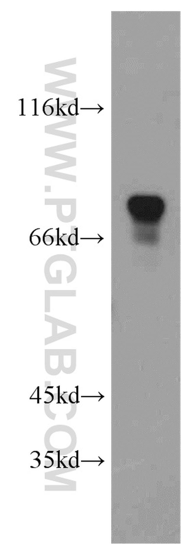 FMRP Antibody in Western Blot (WB)