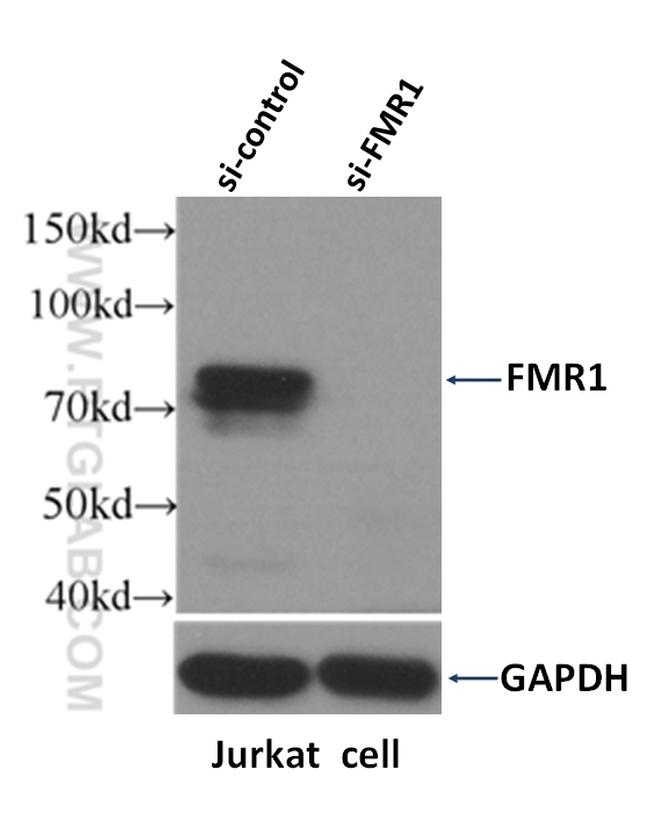 FMRP Antibody in Western Blot (WB)