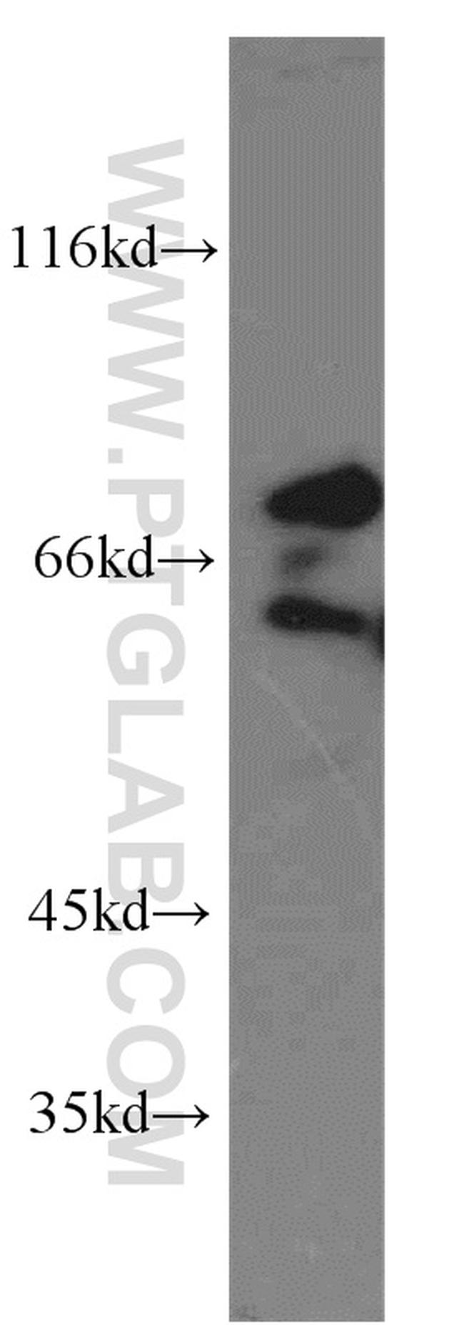 FMRP Antibody in Western Blot (WB)