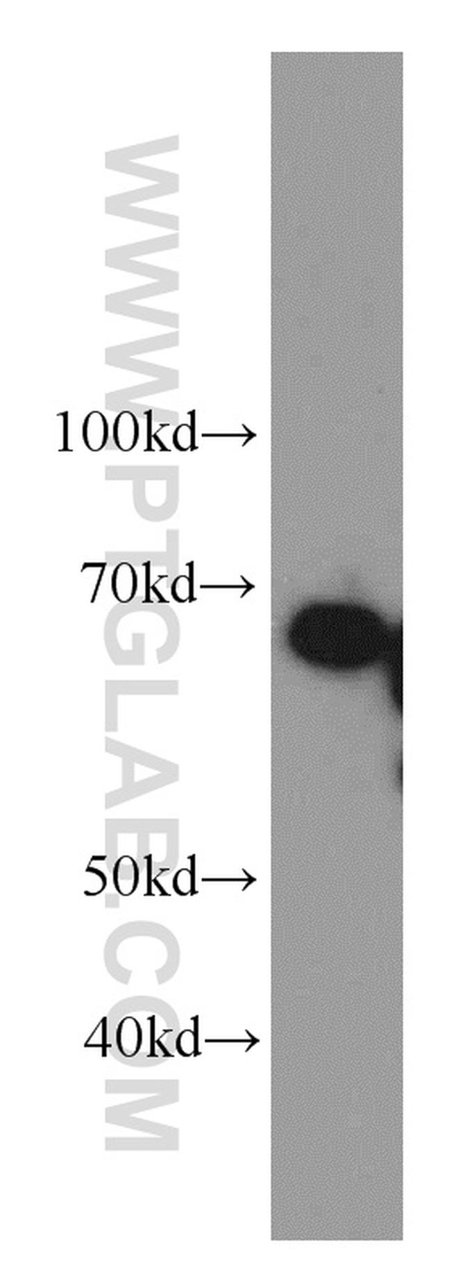 FMRP Antibody in Western Blot (WB)