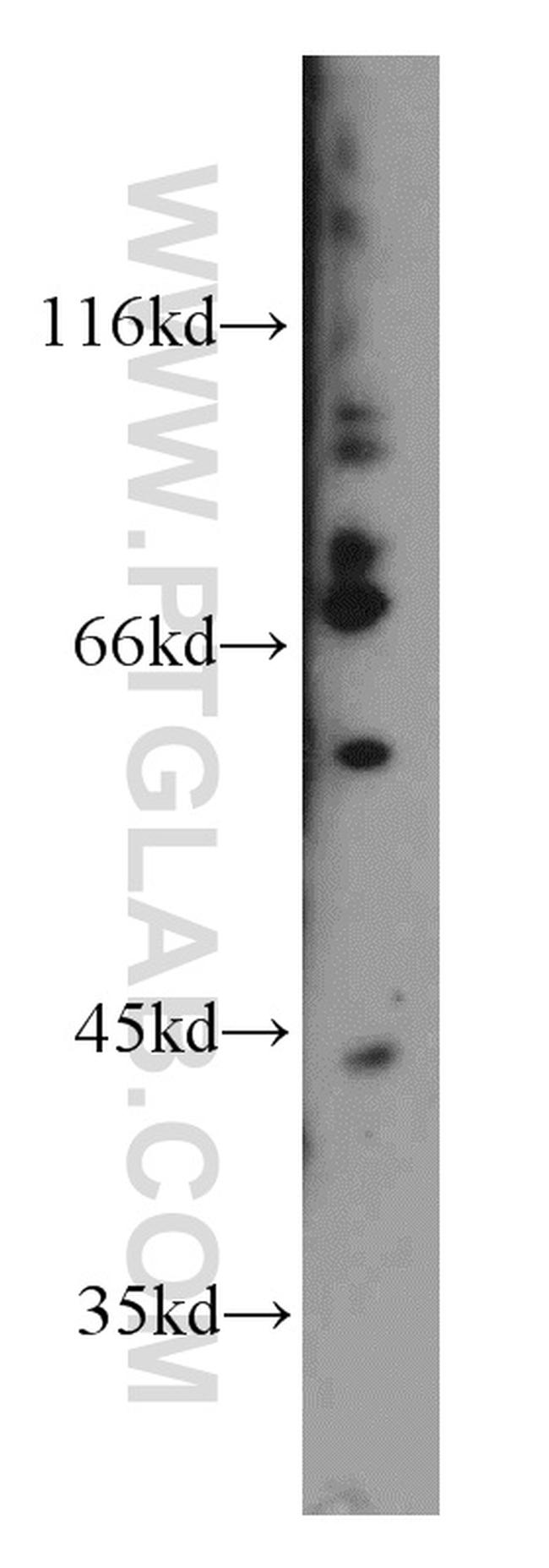 FMRP Antibody in Western Blot (WB)