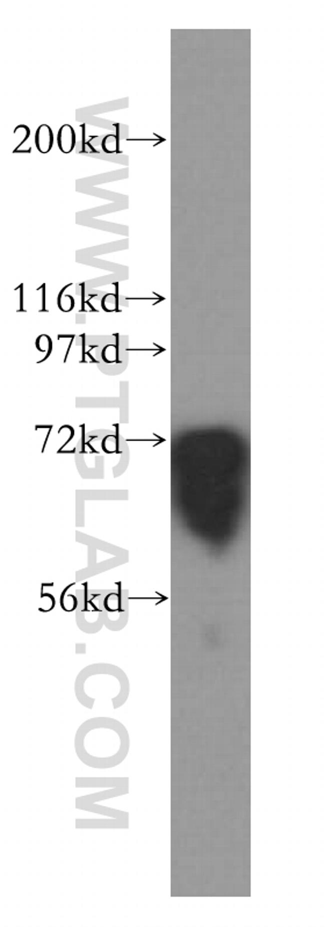 FMRP Antibody in Western Blot (WB)