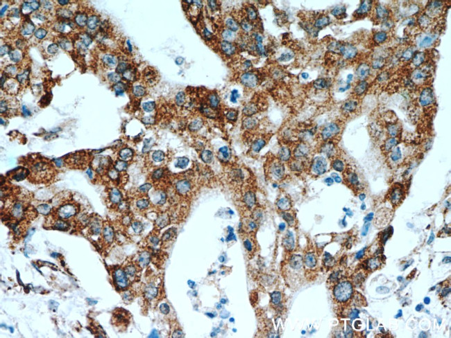 P4HA2 Antibody in Immunohistochemistry (Paraffin) (IHC (P))