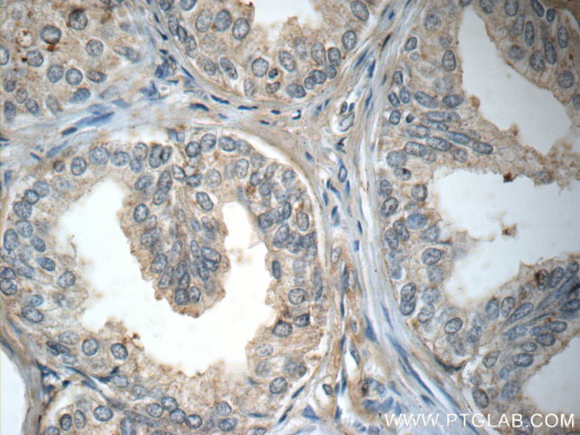 P4HA2 Antibody in Immunohistochemistry (Paraffin) (IHC (P))