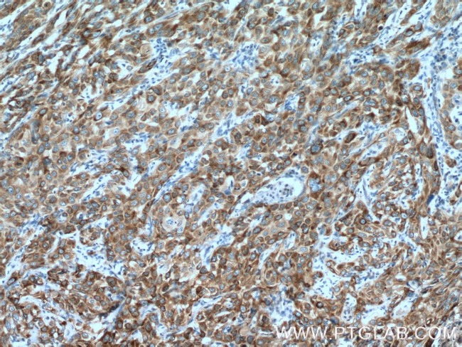 P4HA2 Antibody in Immunohistochemistry (Paraffin) (IHC (P))