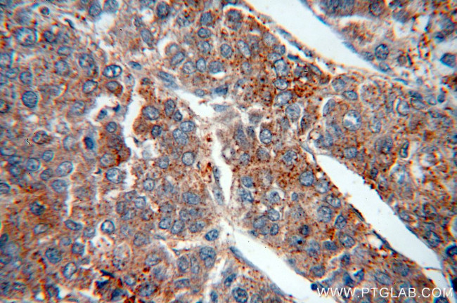 AMBRA1 Antibody in Immunohistochemistry (Paraffin) (IHC (P))