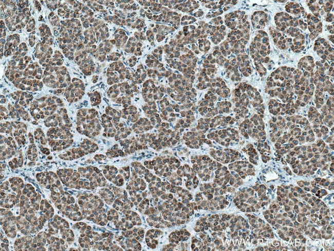 AMBRA1 Antibody in Immunohistochemistry (Paraffin) (IHC (P))