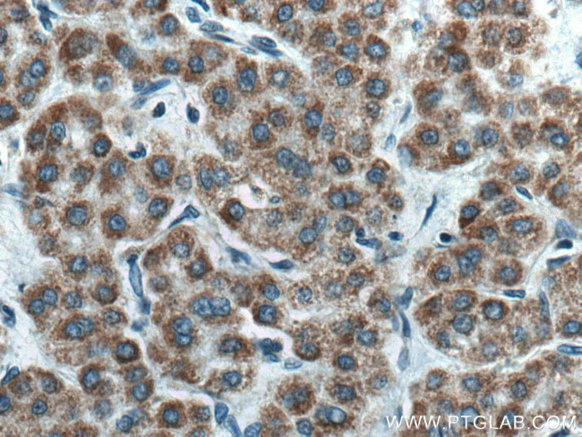 AMBRA1 Antibody in Immunohistochemistry (Paraffin) (IHC (P))