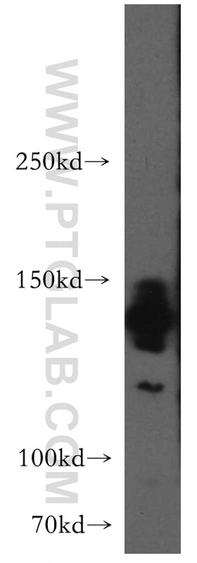 AMBRA1 Antibody in Western Blot (WB)