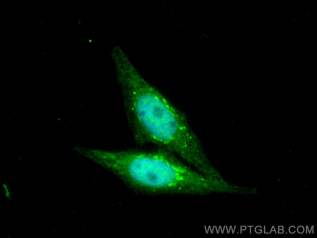 PFKFB3 Antibody in Immunocytochemistry (ICC/IF)