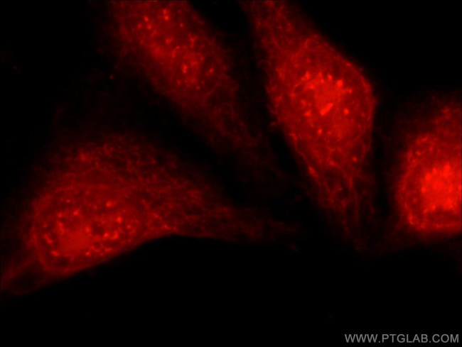 PFKFB3 Antibody in Immunocytochemistry (ICC/IF)