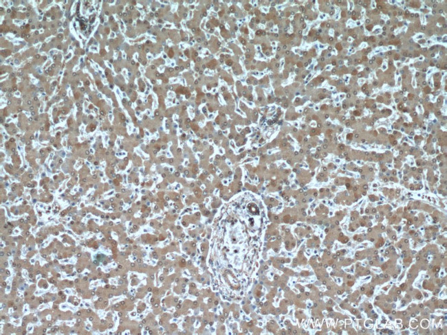 PFKFB3 Antibody in Immunohistochemistry (Paraffin) (IHC (P))