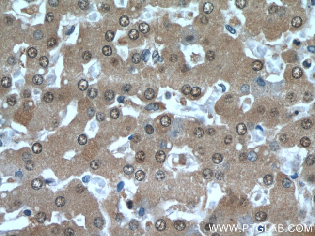 PFKFB3 Antibody in Immunohistochemistry (Paraffin) (IHC (P))