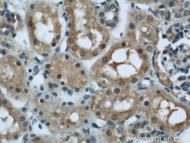 PFKFB3 Antibody in Immunohistochemistry (Paraffin) (IHC (P))