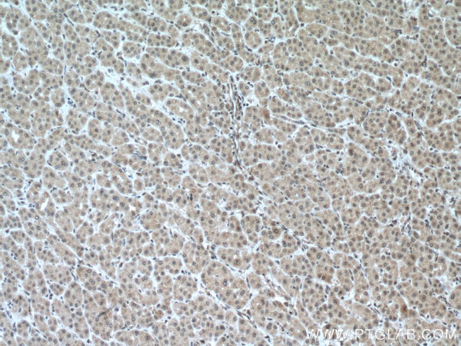 PFKFB3 Antibody in Immunohistochemistry (Paraffin) (IHC (P))