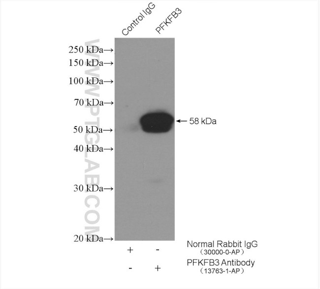 PFKFB3 Antibody in Immunoprecipitation (IP)