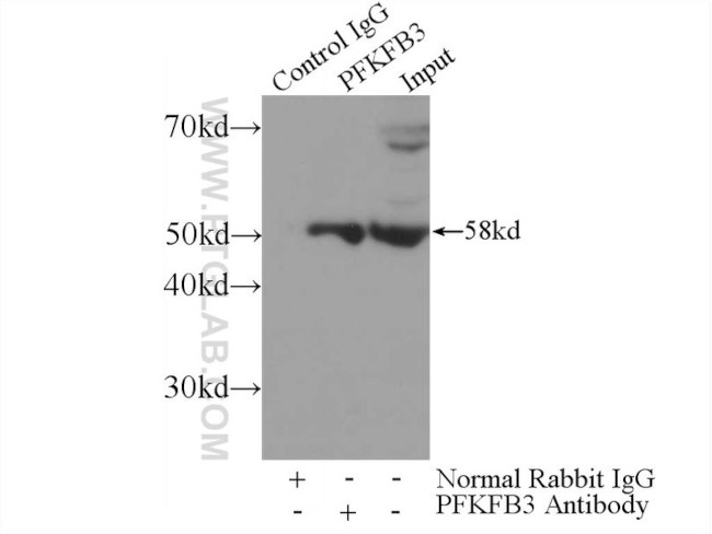 PFKFB3 Antibody in Immunoprecipitation (IP)