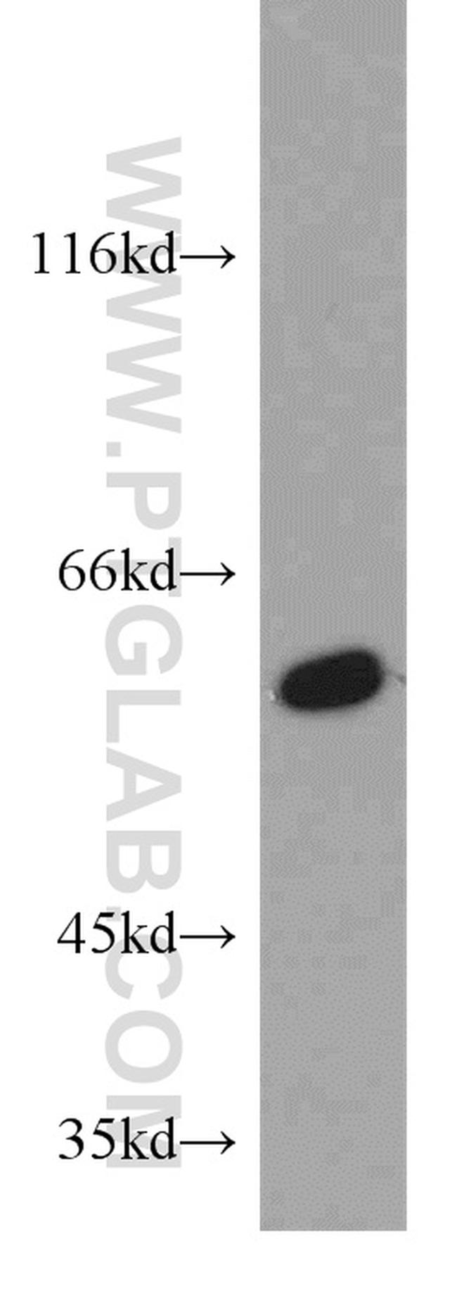 PFKFB3 Antibody in Western Blot (WB)