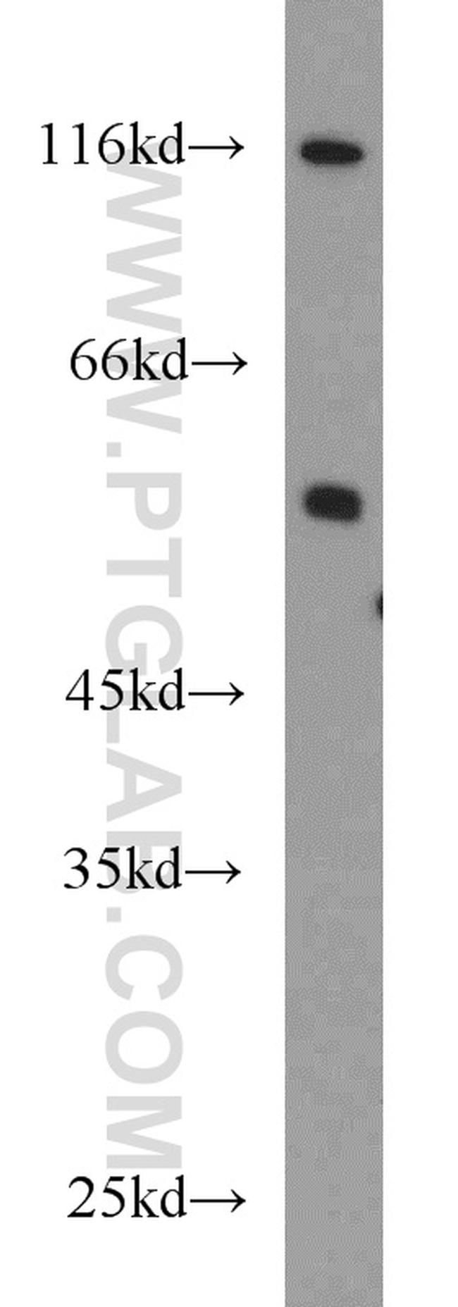 PFKFB3 Antibody in Western Blot (WB)