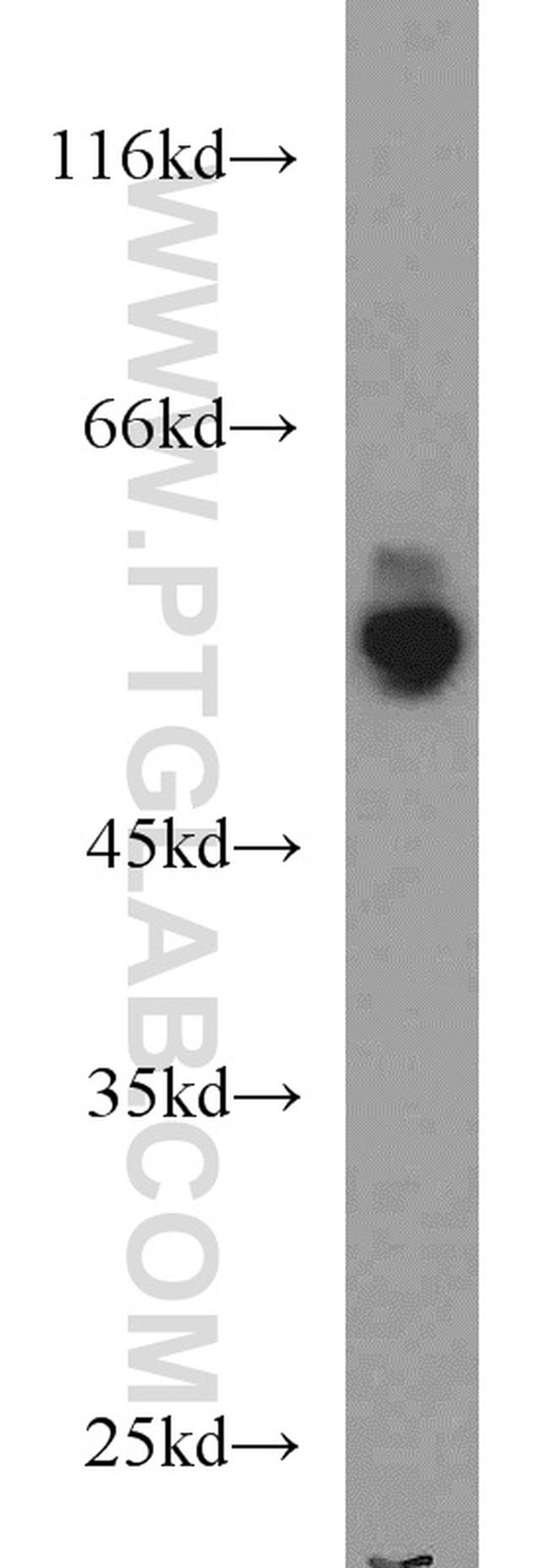 PFKFB3 Antibody in Western Blot (WB)