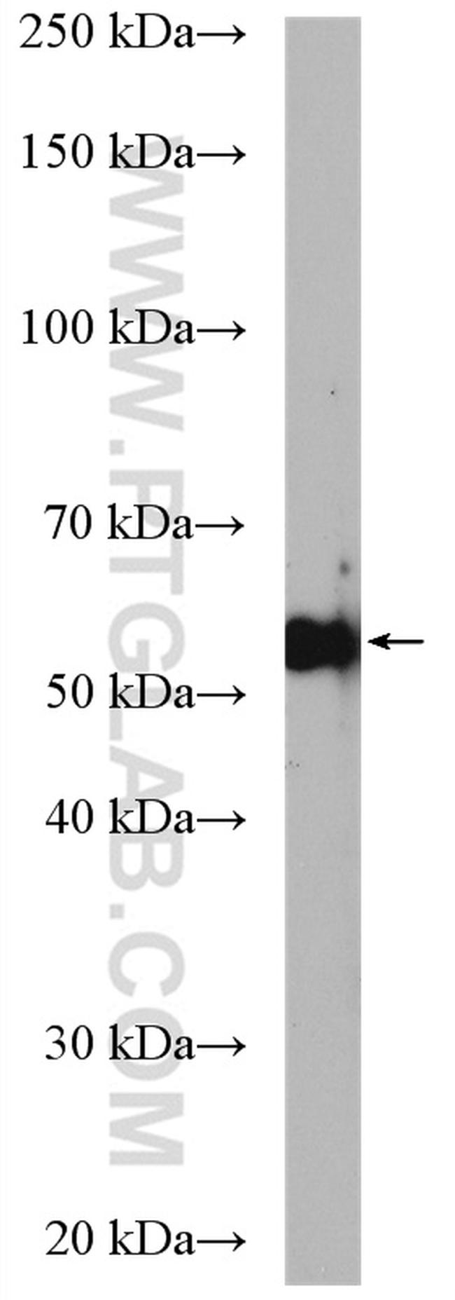 PFKFB3 Antibody in Western Blot (WB)