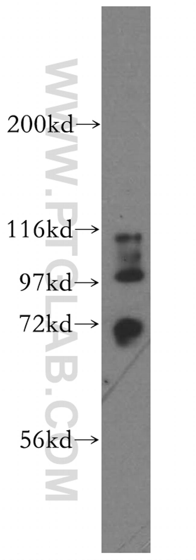 STXBP3 Antibody in Western Blot (WB)