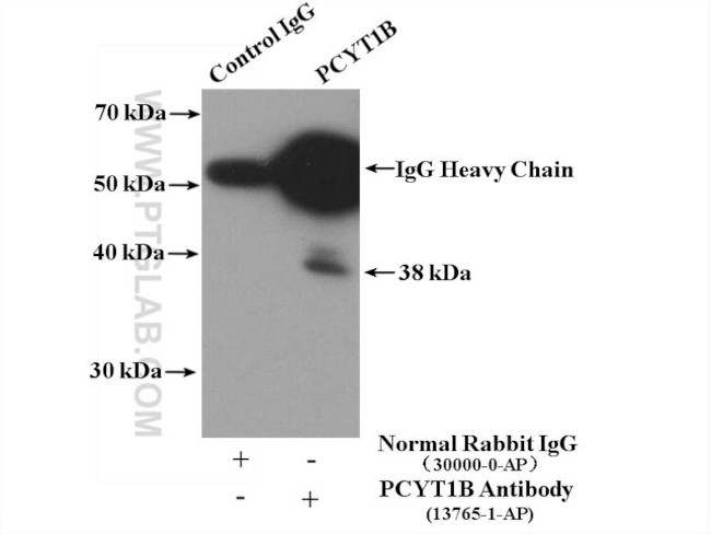 PCYT1B Antibody in Immunoprecipitation (IP)