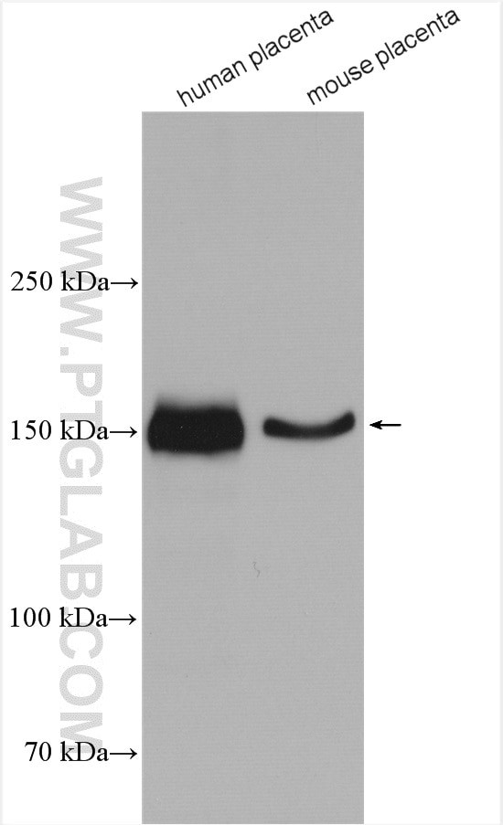 Entactin Antibody in Western Blot (WB)