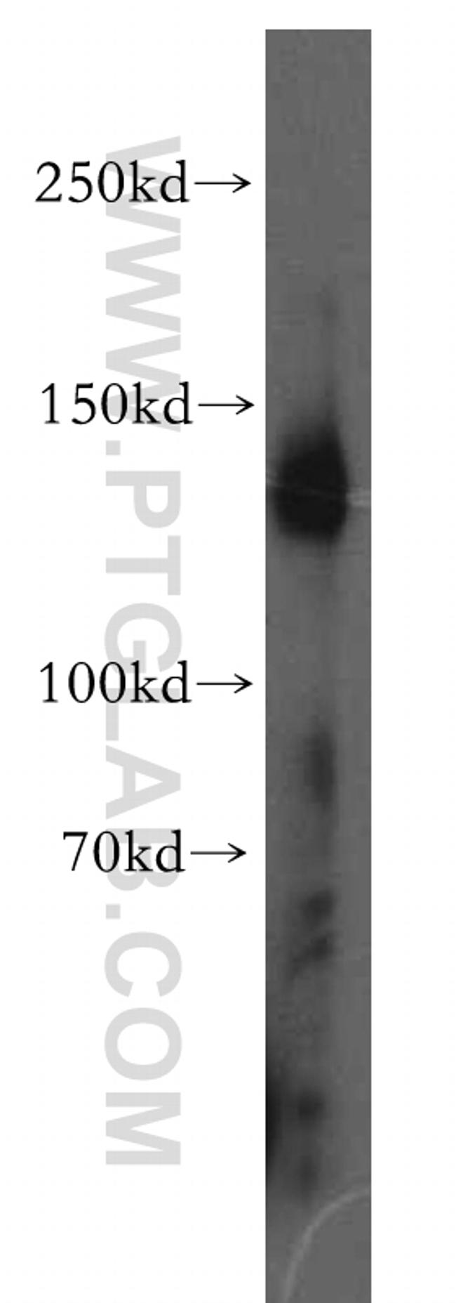 Entactin Antibody in Western Blot (WB)