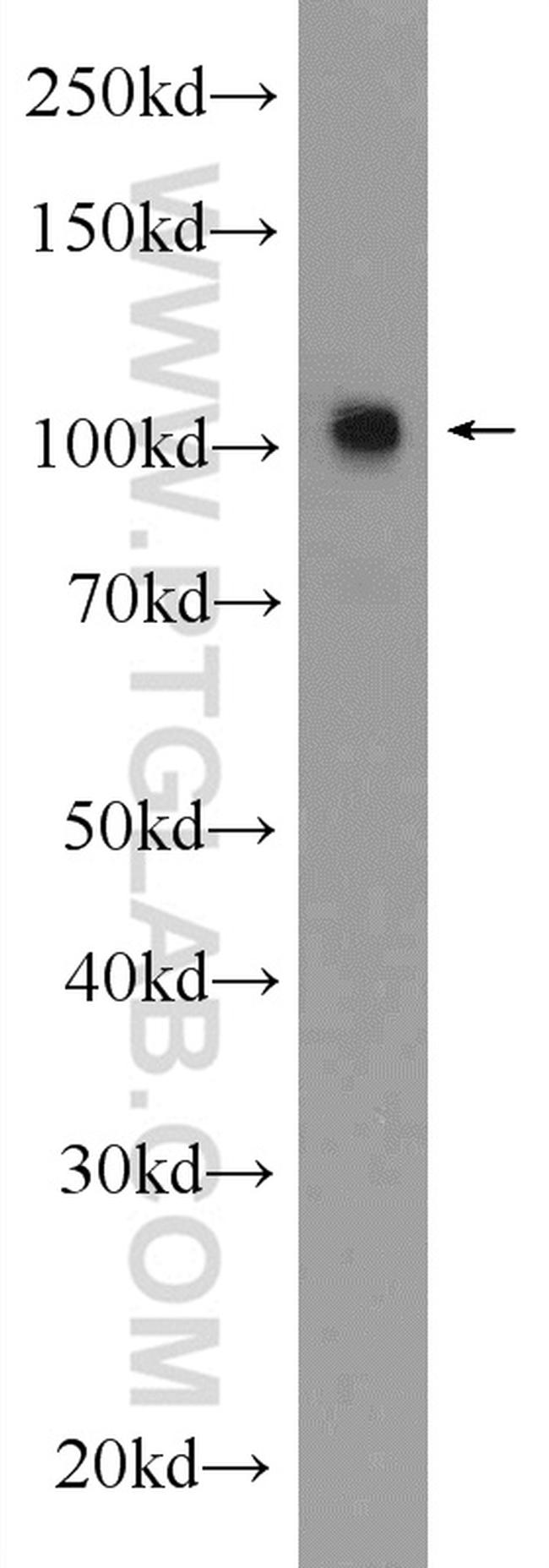 GPRIN1 Antibody in Western Blot (WB)