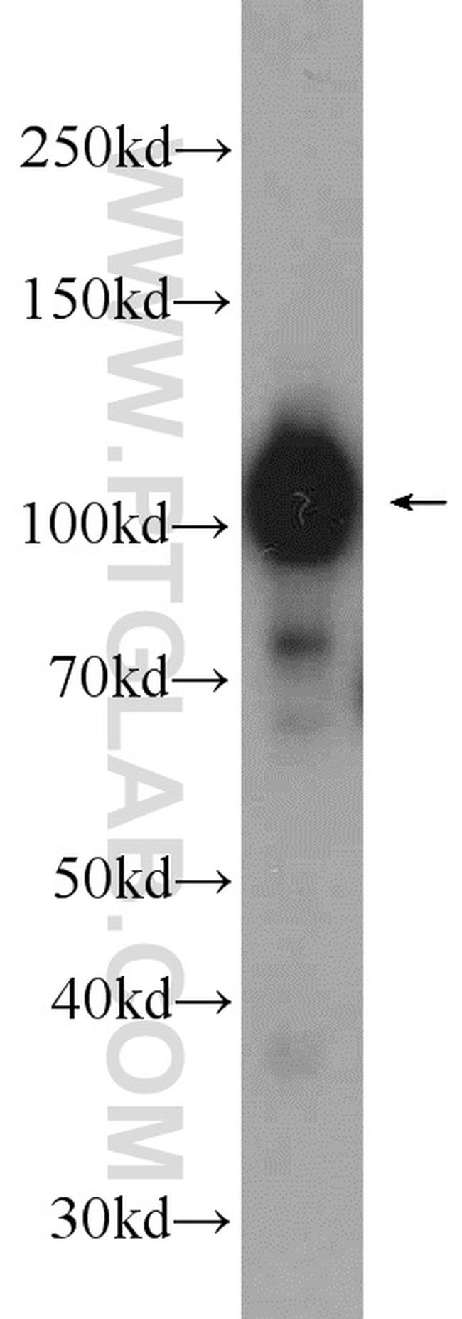 GPRIN1 Antibody in Western Blot (WB)