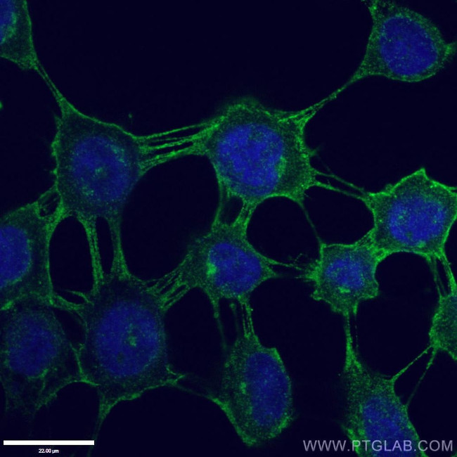 P-cadherin Antibody in Immunocytochemistry (ICC/IF)