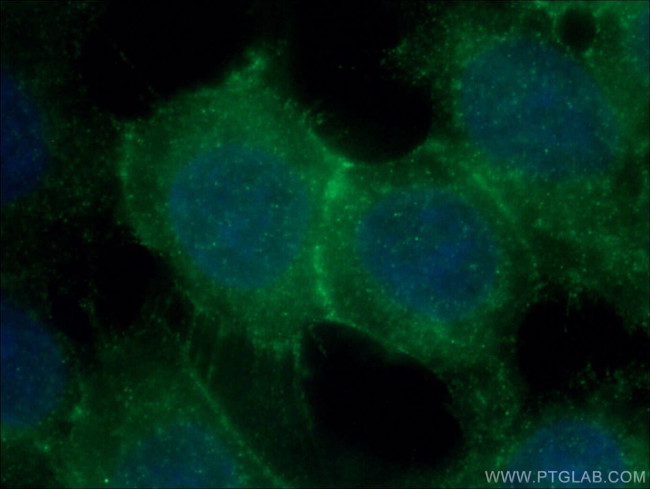 P-cadherin Antibody in Immunocytochemistry (ICC/IF)