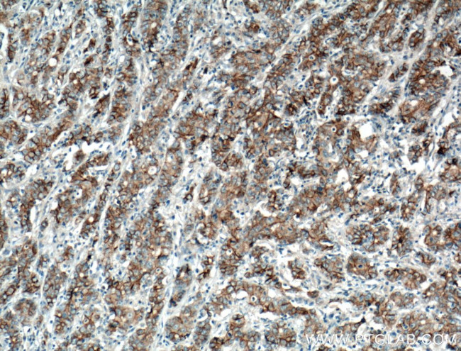 P-cadherin Antibody in Immunohistochemistry (Paraffin) (IHC (P))