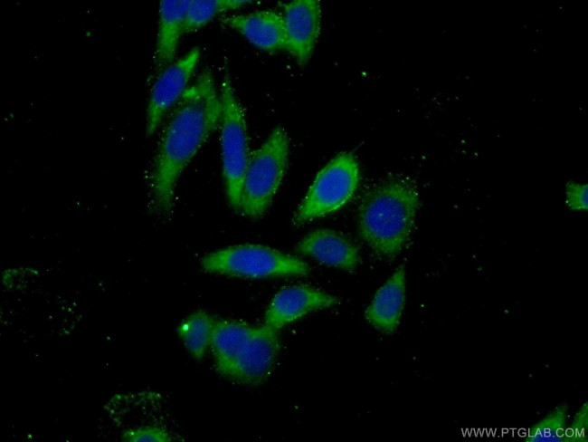 DZIP1 Antibody in Immunocytochemistry (ICC/IF)