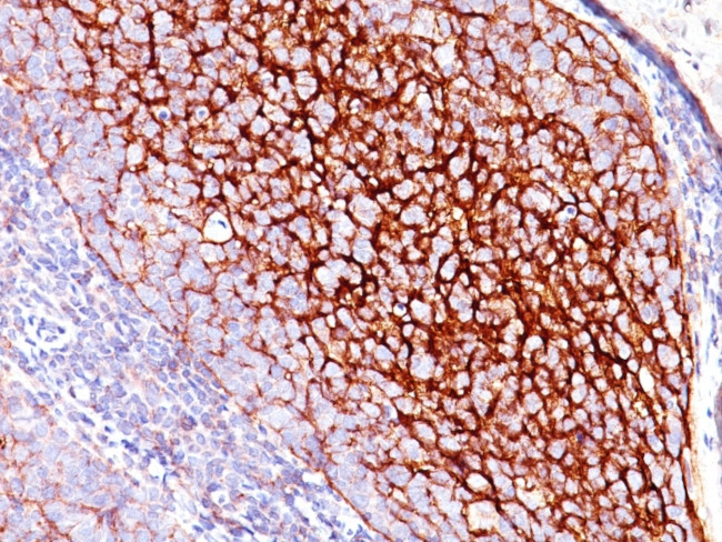 CD35/CR1 (Follicular Dendritic Cell Marker) Antibody in Immunohistochemistry (Paraffin) (IHC (P))