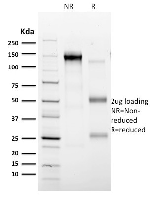 CD35/CR1 (Follicular Dendritic Cell Marker) Antibody in SDS-PAGE (SDS-PAGE)