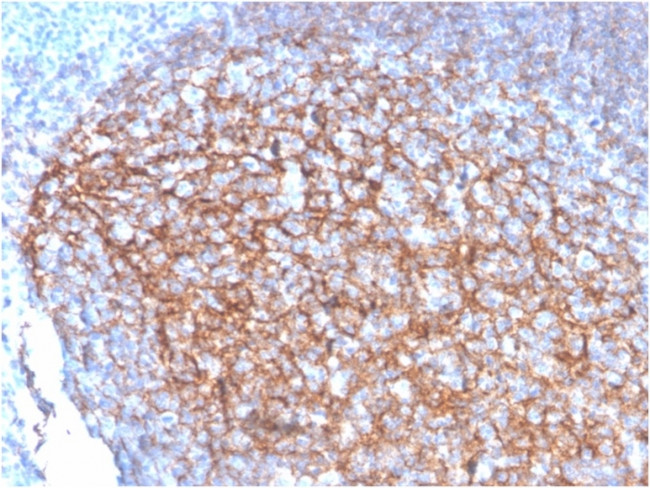 CD35/CR1 (Follicular Dendritic Cell Marker) Antibody in Immunohistochemistry (Paraffin) (IHC (P))